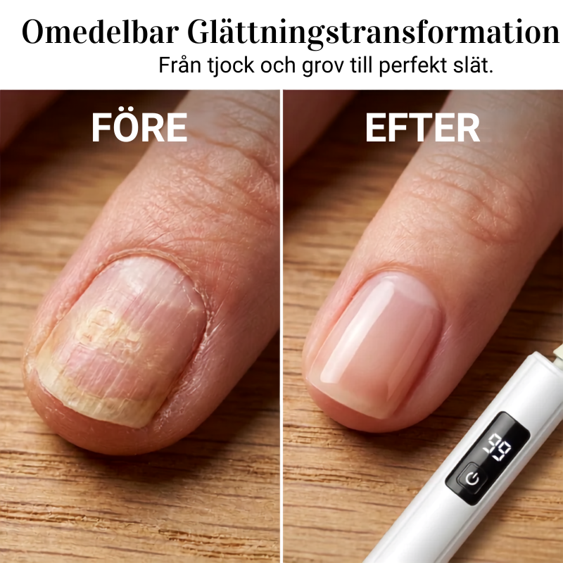 Professionell Elektrisk Nagelfil