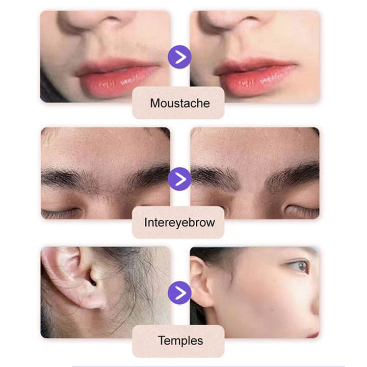 💖 Mild & Smärtfri Ansikts-Hårborttagningskräm – 100% Naturlig och Dermatologiskt Testad! 🌿✨